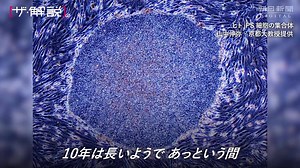 iPSの網膜「順調」 世界初移植から5年、女性の患者 https://www.asahi.com/articles/ASN585FGVN3FPLBJ004.html 夢の技術 #iPS細胞 。 目の難病や神経の病気など、iPS細胞からつくった細胞の移植手術が実施され、今年１月には初めて心臓への移植も。 ノーベル賞受賞から８年、 #山中伸弥 教授らが語る、iPS細胞研究の現状は。 #ザ解説 | 朝日新聞（The Asahi Shimbun）