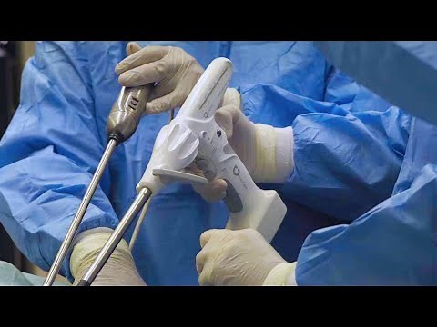 IntoCare Powered Stapler of Proven Stability and Safety