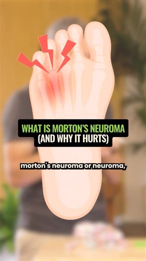 Podiatrist Breaks Down Morton’s Neuroma (And What Actually Helps) 🦶