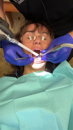 Spooky throwback. Hopefully I can get in and fix my upper plate soon😅 #toothlessandruthless #throwback #dentalimplants