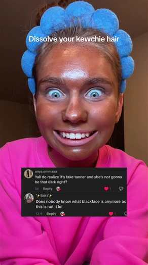 Except im sick and have sun poisoning so i do look crazy now… but seriously this oil has changed everything for me