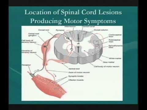 Clinical Significance of Demyelinating Lesions of the Central Nervous System