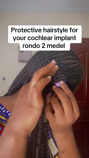 Protective Hairstyle for Cochlear Implant Rondo 2