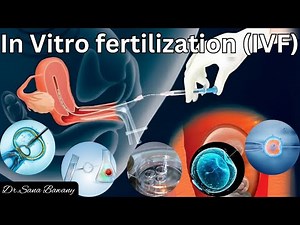 IVF Complete Process Step By Step || In Vitro Fertilization Procedure