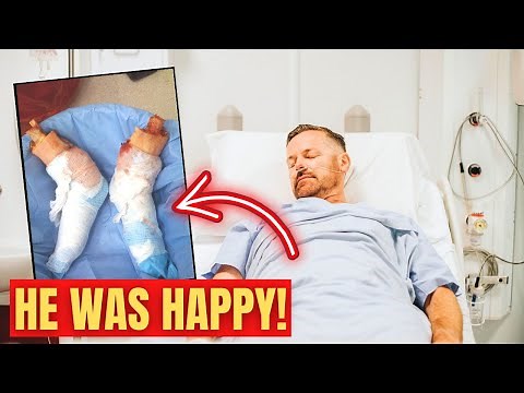 Orthopedic Surgeon Explains A DOUBLE LEG AMPUTATION (BELOW KNEE) | Dr. Chris Raynor