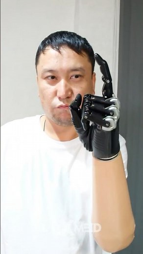 The Bebionic Hand experience of a below-elbow arm amputee